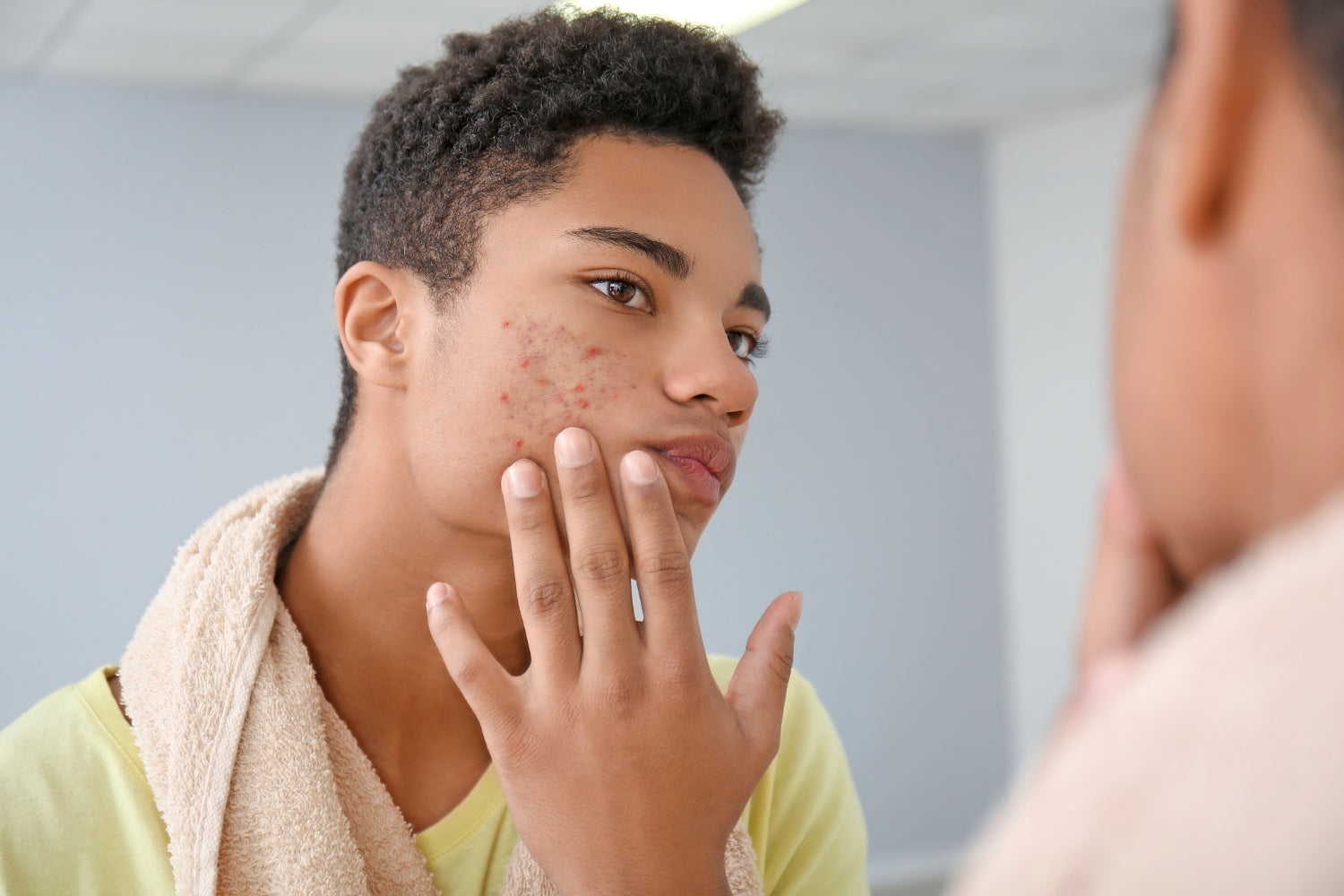 how hormones affect skin
